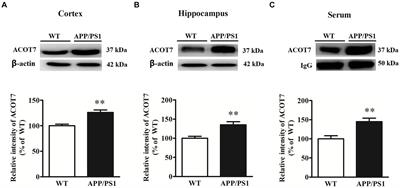 ACOT7, a candidate and novel serum biomarker of Alzheimer’s disease